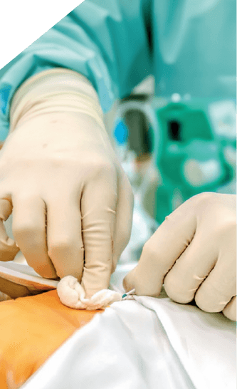 Cuidados críticos intensivos | CCI